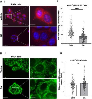 Beneficial effects of bempedoic acid treatment in polycystic kidney disease cells and mice